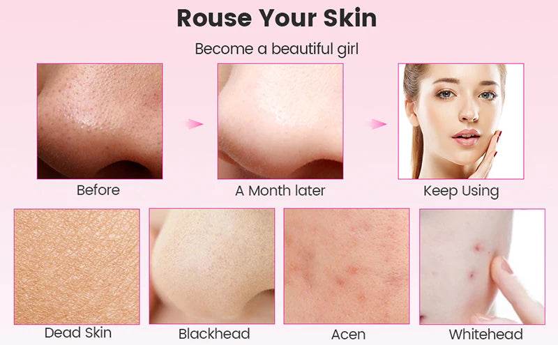 Ultrasonic Skin Scrubber