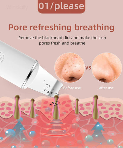 Ultrasonic Skin Scrubber